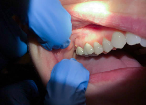 Best Emergency Care for Gum Disease in Filer, ID